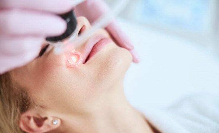 Ärzte in Adliswil informieren: Moderne Hautverschönerung mit Laser-Technologie